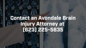 contact an avondale brain injury attorney today