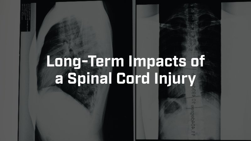 long term impacts of a spinal cord injury